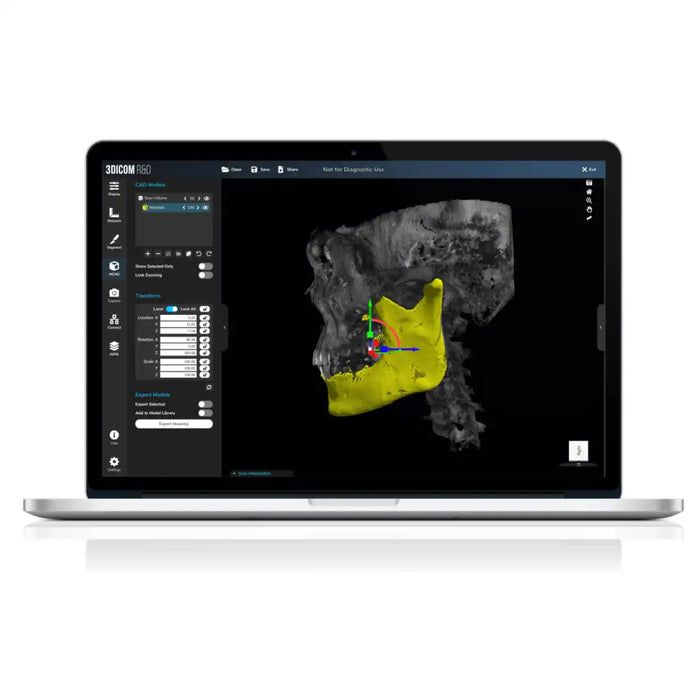 Tampilan Software R&d Work 3Dicom Viewer Software - R&D — Knoxlabs