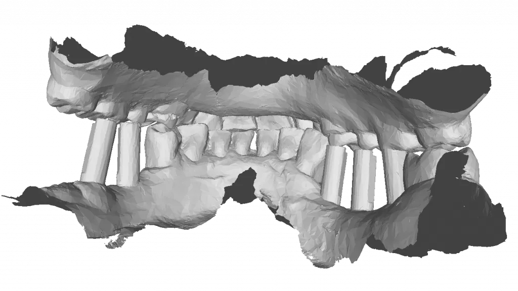 HoloDentist | Dental XR Communication & Simulation Platform